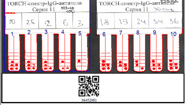 16-2 pic11-2015