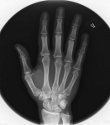 x-ray
